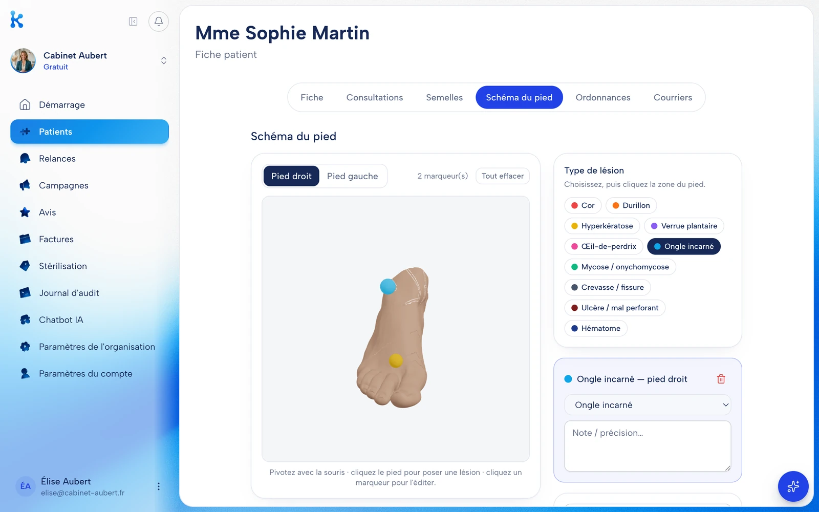 KOMPER : Schéma du pied